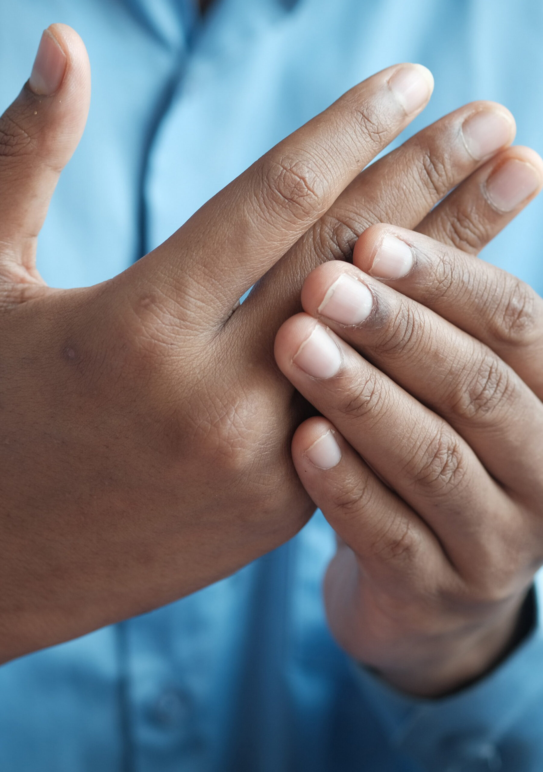 Platelet rich plasma injections for arthritis. Opus Biological