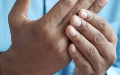 Platelet rich plasma injections for arthritis.