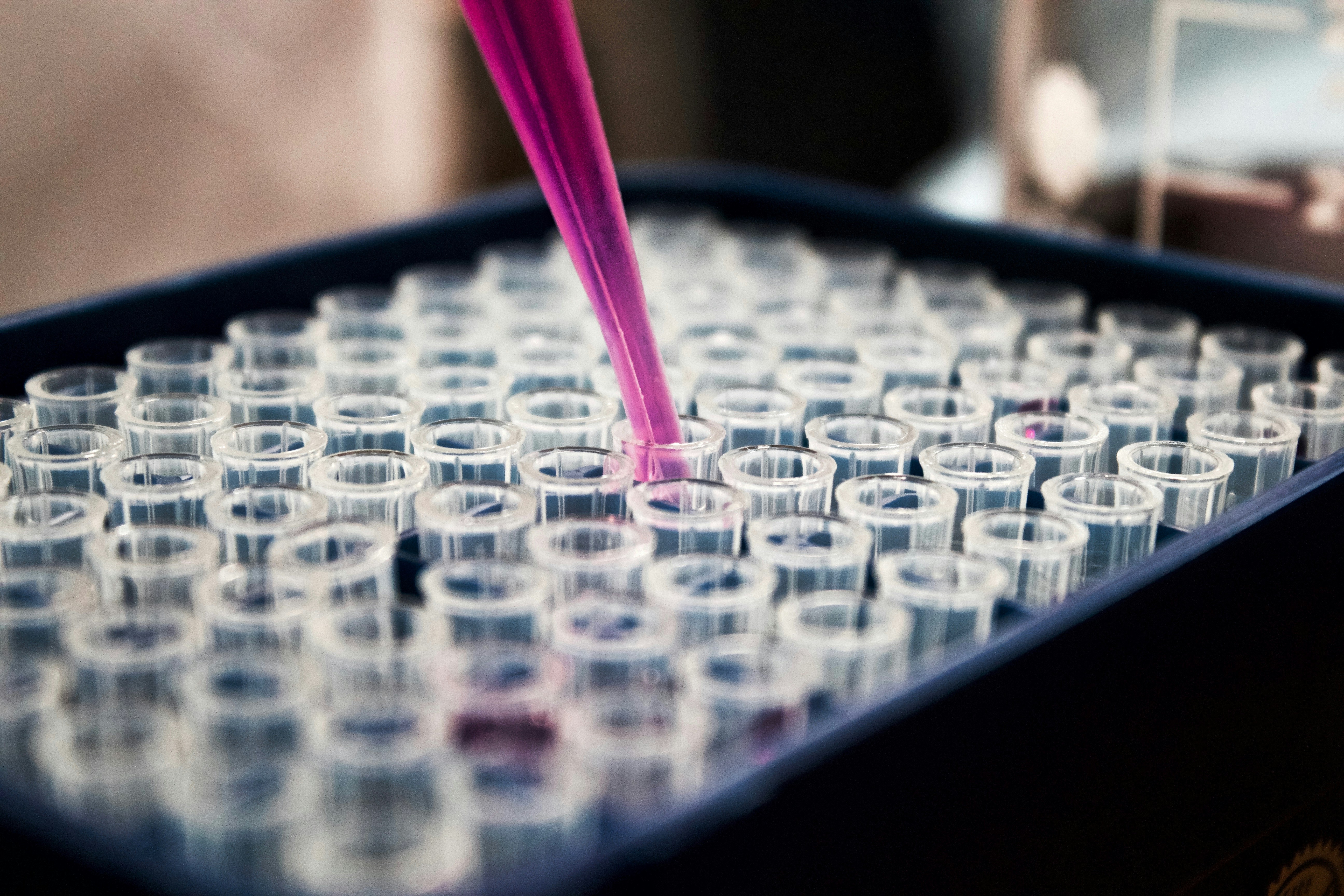 Platelet rich plasma injections for tendonitis