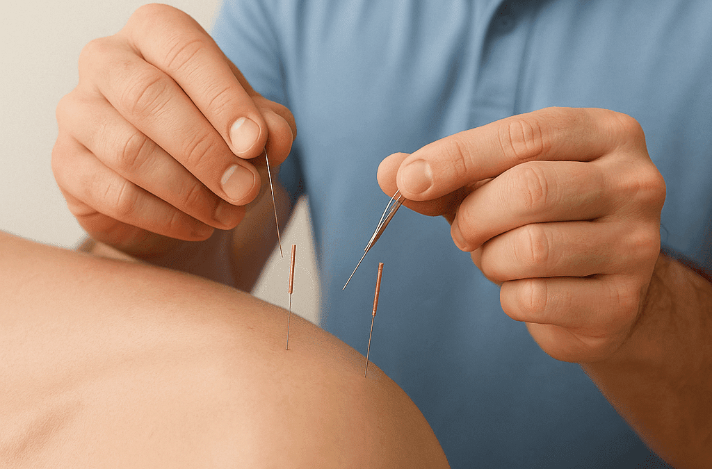 Western Acupuncture and Dry Needling in the management of Musculoskeletal Conditions