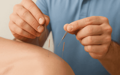 Western Acupuncture and Dry Needling in the management of Musculoskeletal Conditions